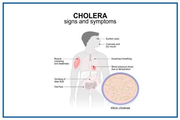 Cholera: Lagos Records Three Fresh Deaths