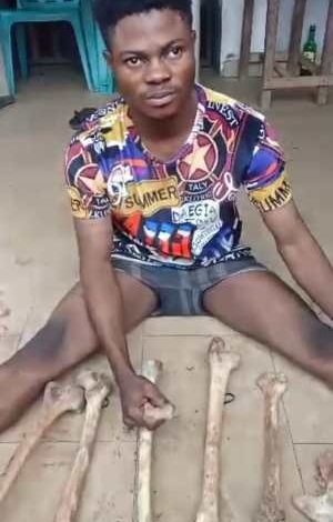 Police Arrest Herbalist With 11 Human Bones