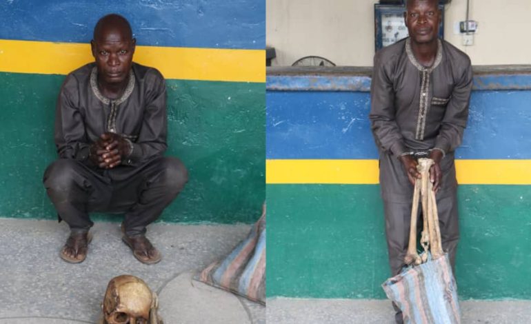 Man Arrested For Selling Human Skull, Bones For N600,000