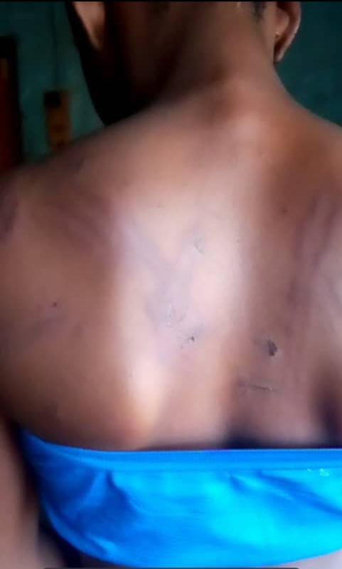 Mother Cries For Help As Vigilante Operatives Allegedly Torture, Rape 15-Year-Od  Daughter 