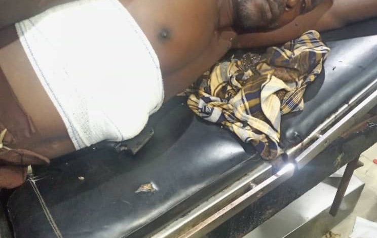 Herbalist Hospitalised After Shooting Self While Testing ‘Bulletproof’ Charm