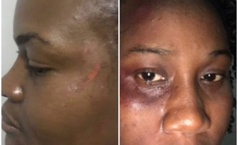 Outrage As NYSC CLO Assaults Two Female Corps Members