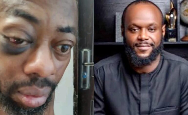 Minister Of Youth, Seyi Tinubu Promised Me N100m To Relinquish My Position – Factional NANS President