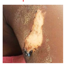Tailor Allegedly Burns Teenage Customer With Hot Iron In Osun
