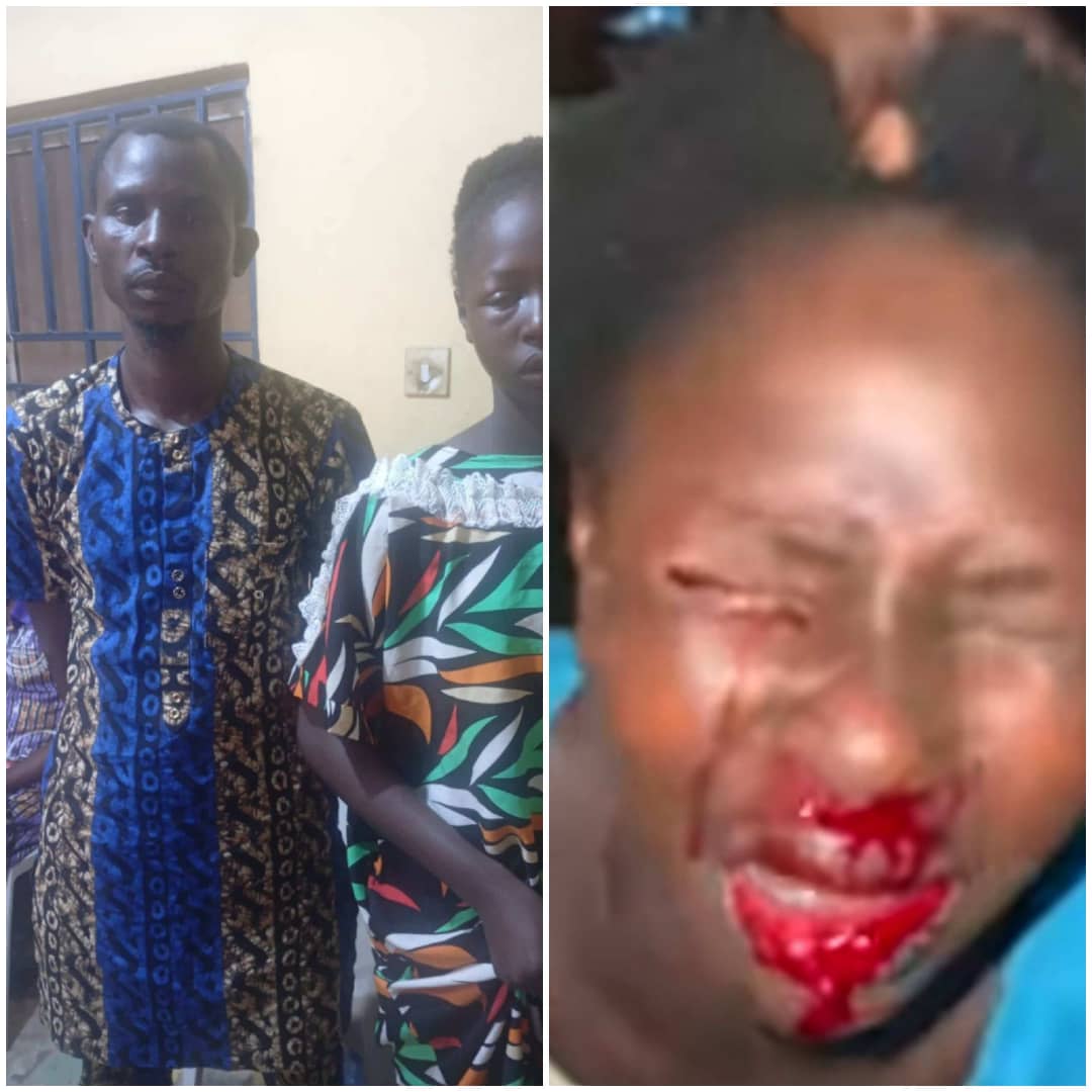 Teenager Loses Sight After Alleged Beating By Father In Osun