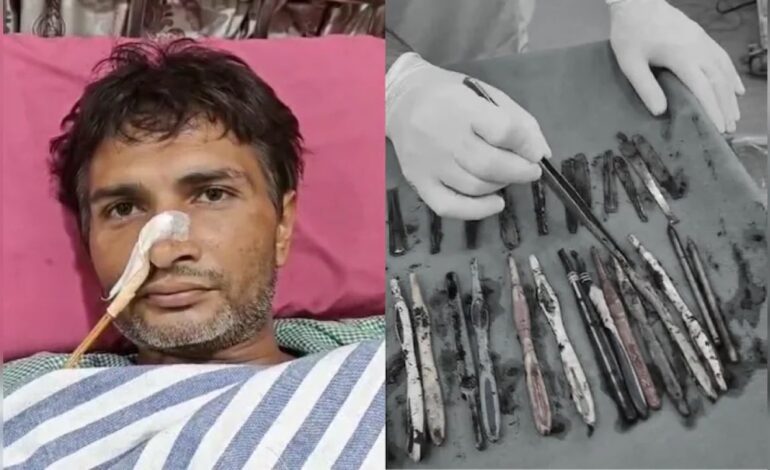 Doctors Remove 29 Spoons, 19 Toothbrushes From Man’s Stomach