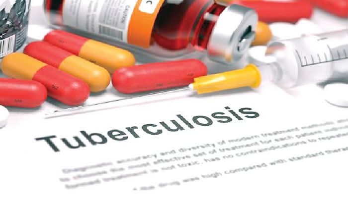 Tuberculosis Not Spiritual Affliction, Osun Govt Tells Residents