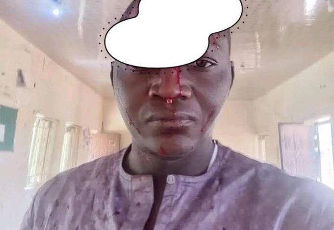 Bauchi Radio Seeks Suspension of DPO Over Alleged Assault On Reporter