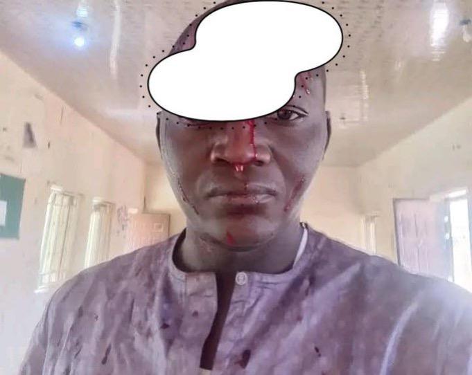 Bauchi Radio Seeks Suspension of DPO Over Alleged Assault On Reporter